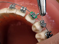 Orthodontie